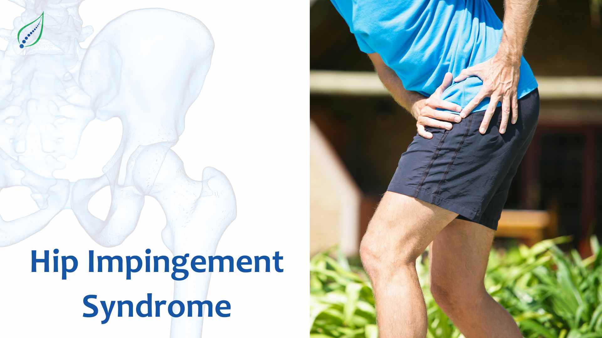 Hip Impingement Syndrome: Causes, Symptoms, & Solutions